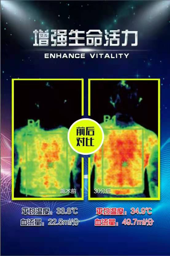 THZ太赫兹技术引领健康产业 重新定义健康新标准